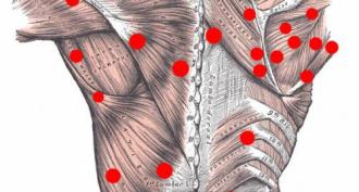 Syndrome myofascial des muscles du dos : causes de douleurs dans toutes les parties de la colonne vertébrale